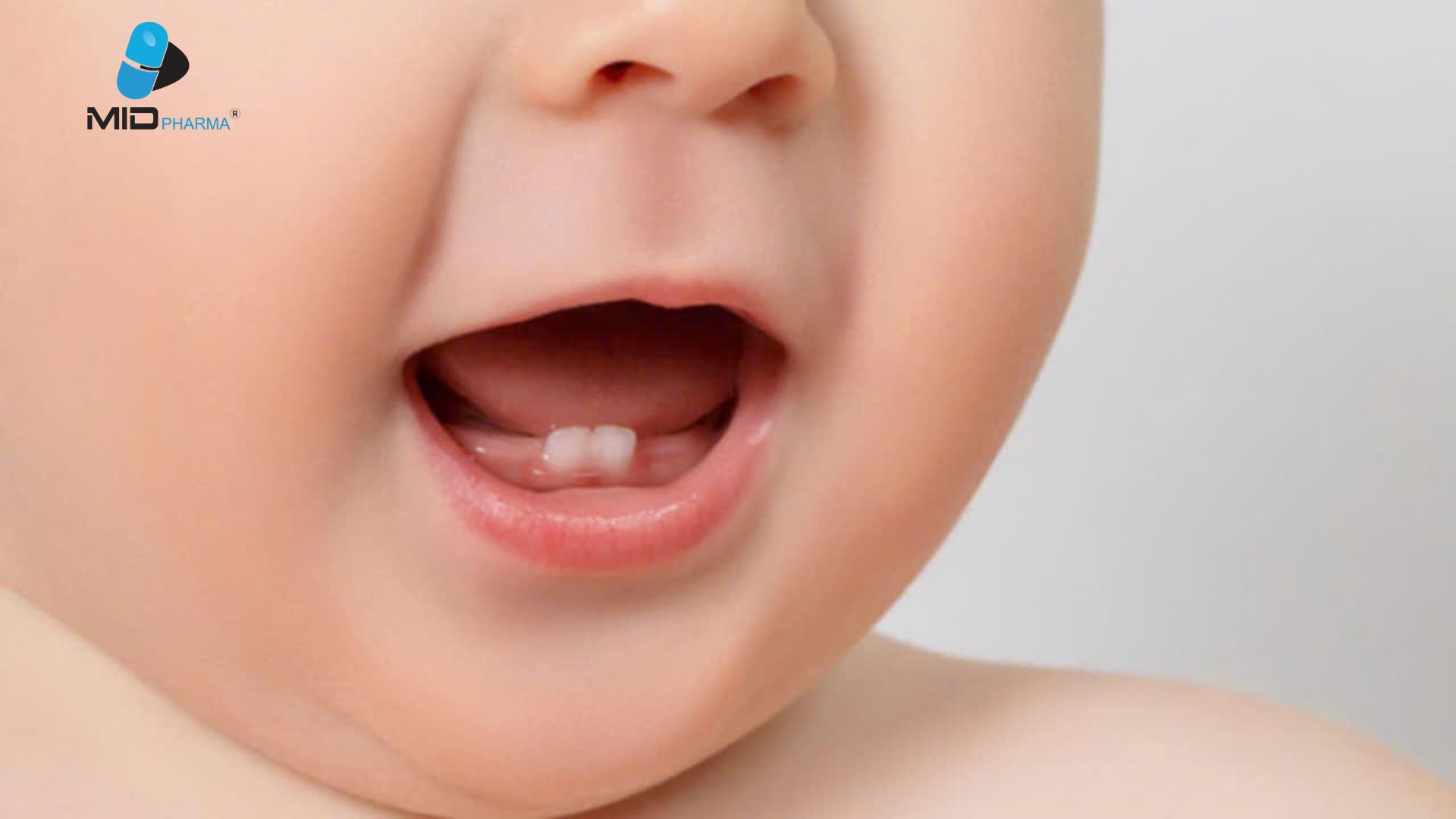 Các dạng thiếu mầm răng ở trẻ